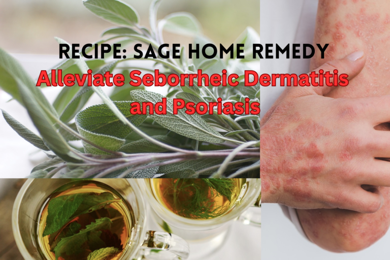 Sage Home Remedies for Seborrheic Dermatitis and Psoriasis