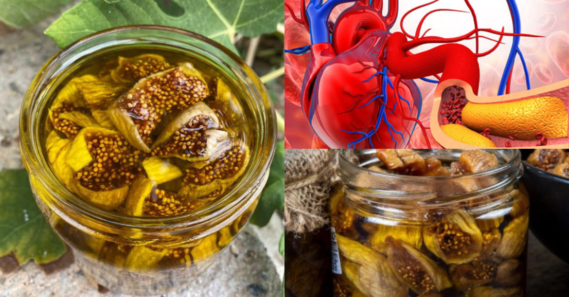 See What Happens When You Combine Dried Figs and Olive Oil for Cholesterol and Digestive Health