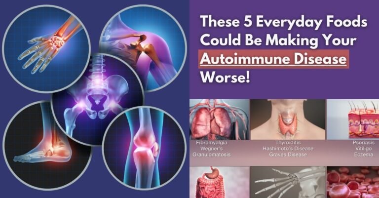 5 Surprising Triggers of Autoimmune Diseases You Might Be Overlooking