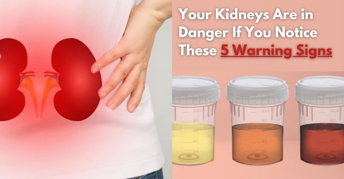 5 Warning Signs Your Kidneys Might Be in Trouble