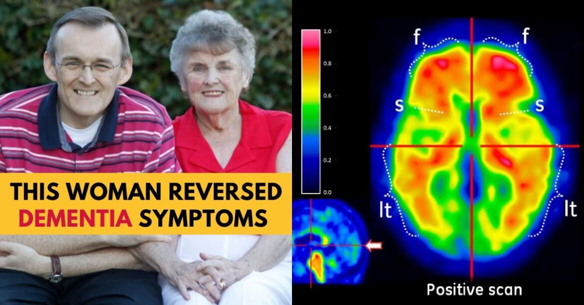 82-Year-Old Woman Reverses Dementia Symptoms with This Simple Diet Change