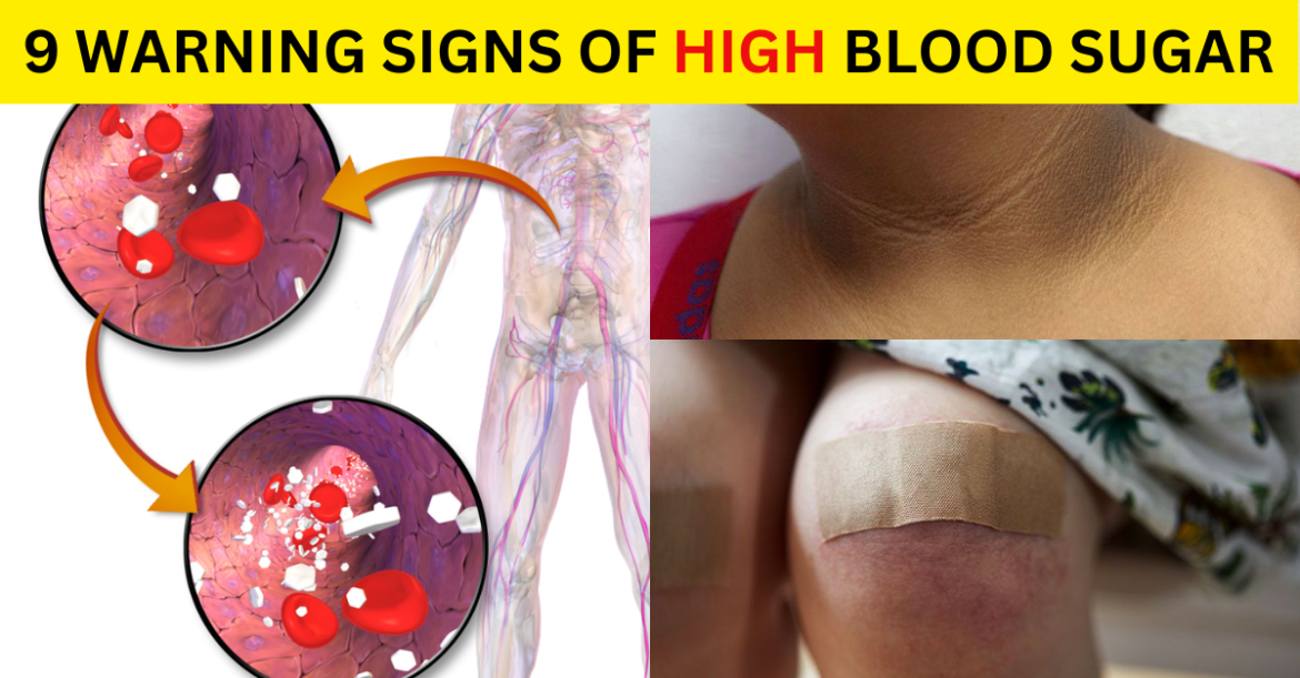 9 Warning Signs of High Blood Sugar You Can’t Ignore