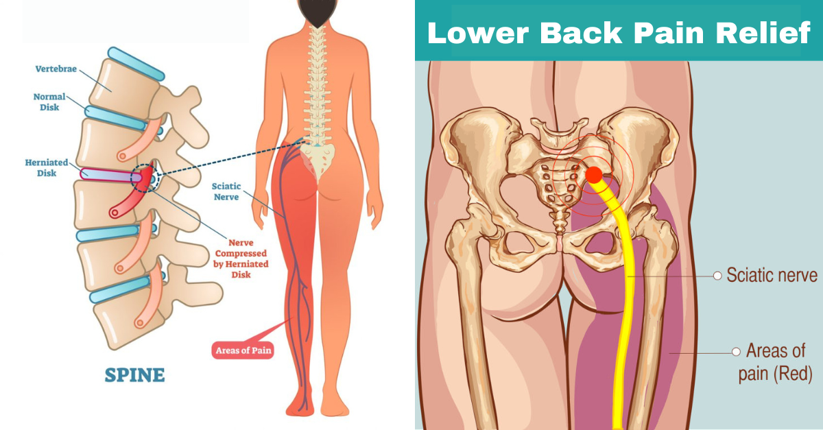 Natural back pain relief with comfrey root