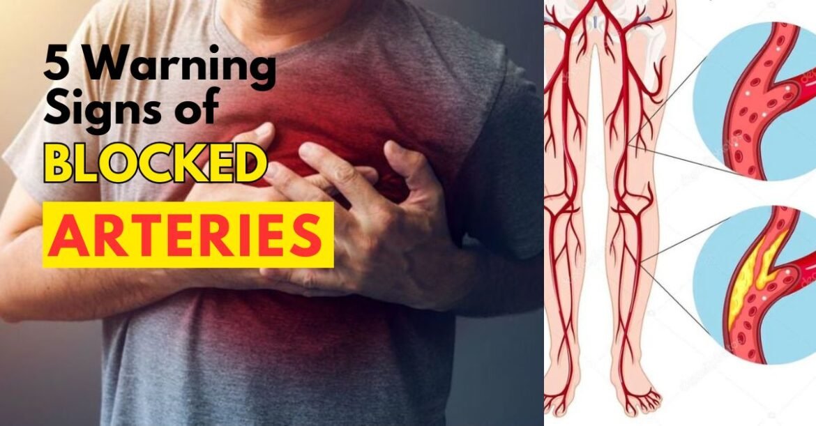 Blocked Arteries? Watch Out for These 5 Silent Warning Signs!