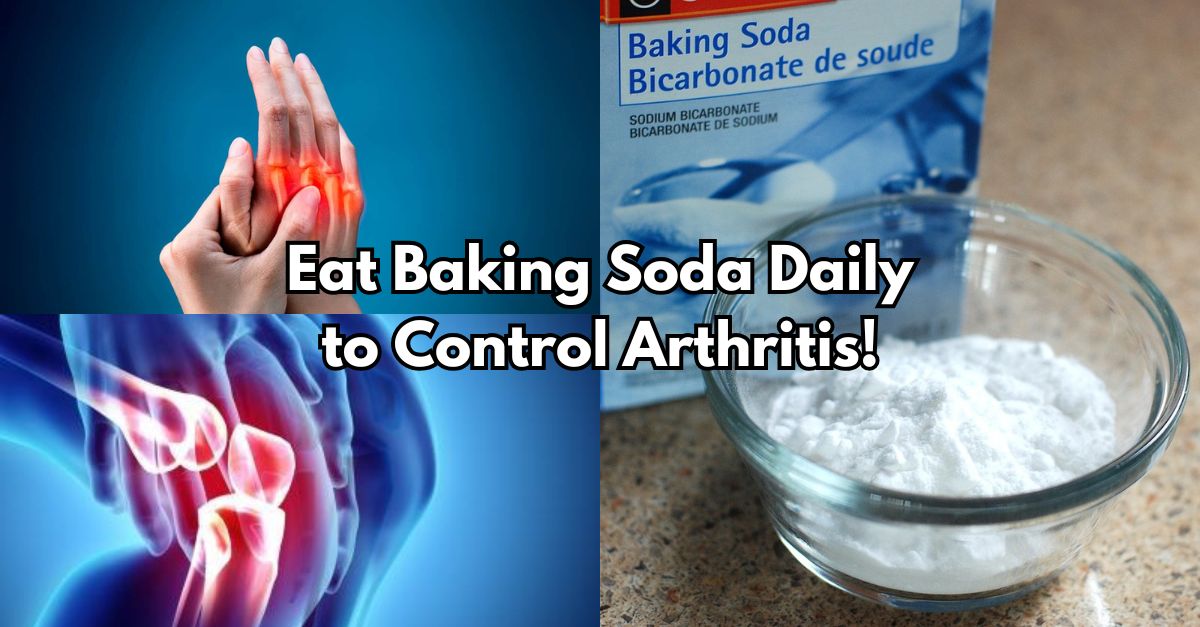 Eat Baking Soda Daily to Control Arthritis!