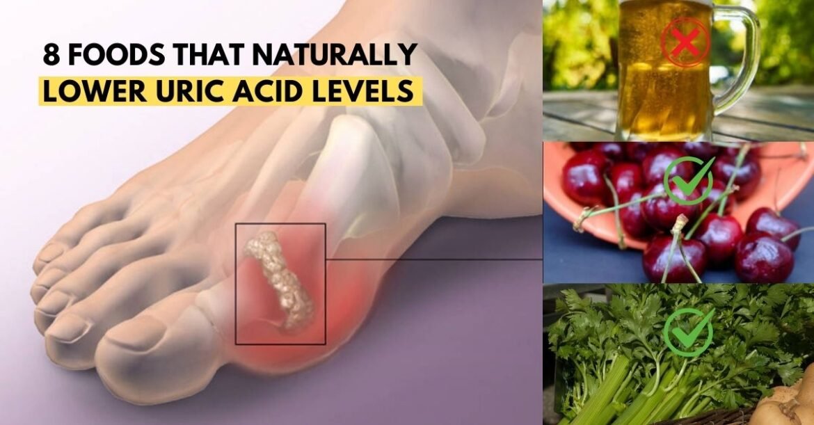 Eat These 8 Foods to Lower Uric Acid and Prevent Gout Naturally