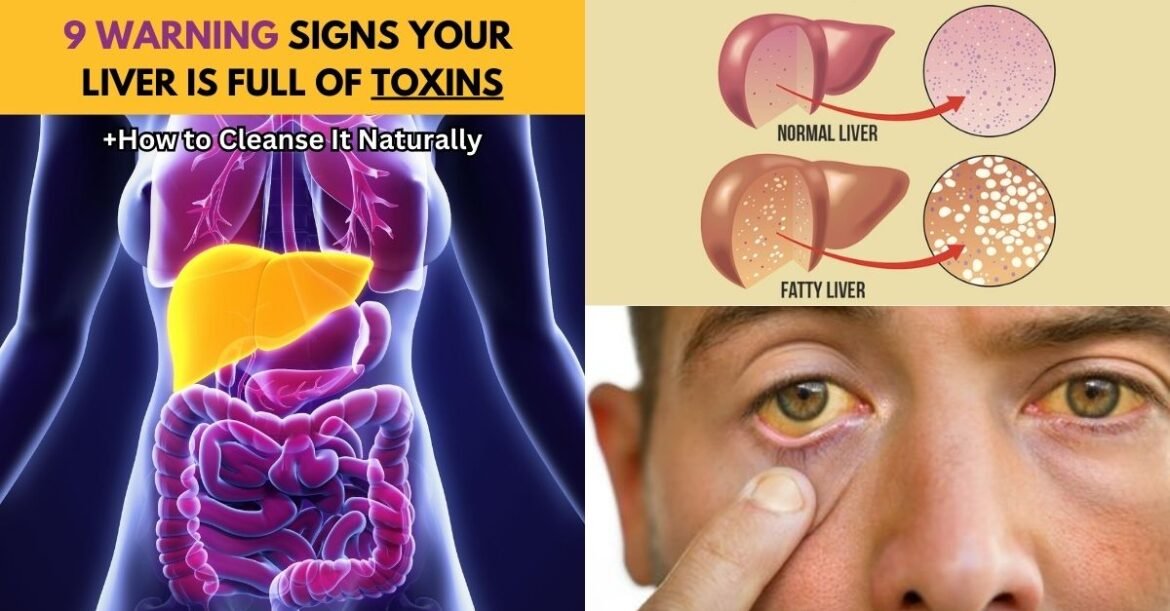 How to Detox Your Liver: 9 Signs It’s Full of Toxins and Leading to Weight Gain