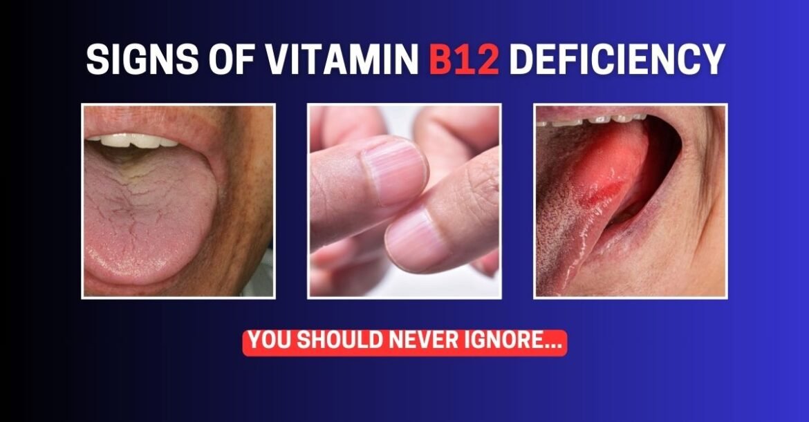 The Truth About Vitamin B12 Deficiency in Just 10 Minutes