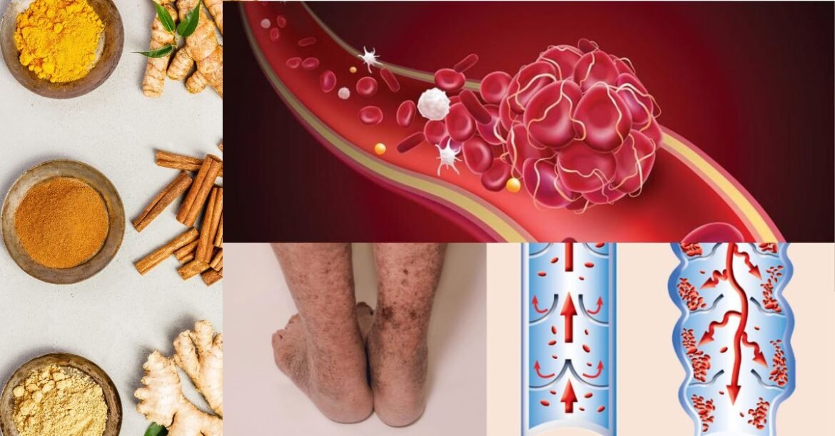 These Powerful Foods Guard Against Deadly Blood Clots and Naturally Thin Your Blood