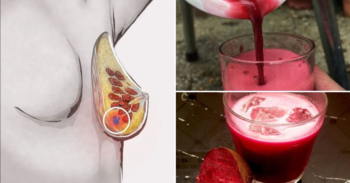 This Miracle Beet Juice Prevents Cancer, Detoxifies Your Liver, and Lowers Blood Pressure!