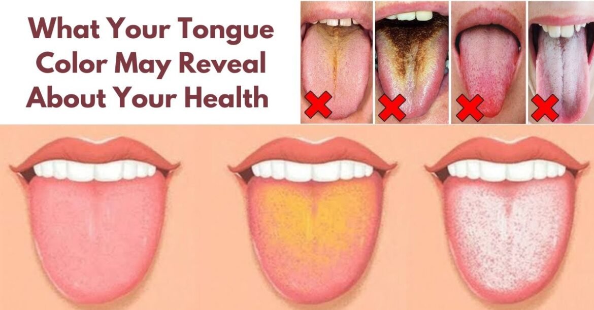 Here’s What Your Tongue Says About Your Health: Don’t Ignore These Signs