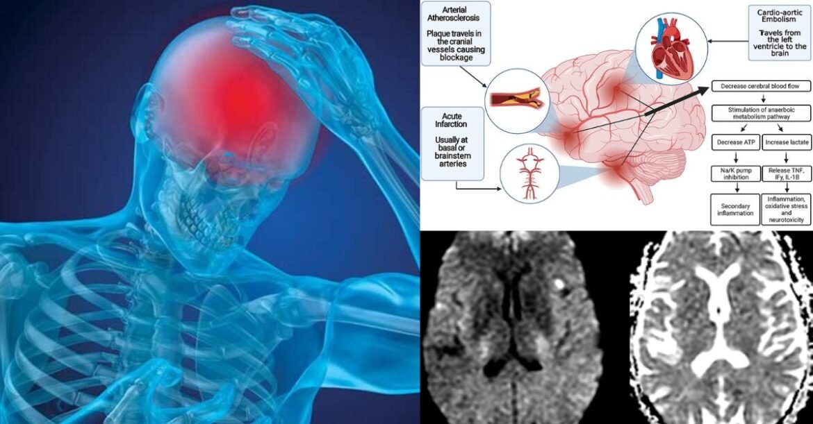 DMSO, the New ‘Ivermectin’ for Brain, Heart, and Stroke Health