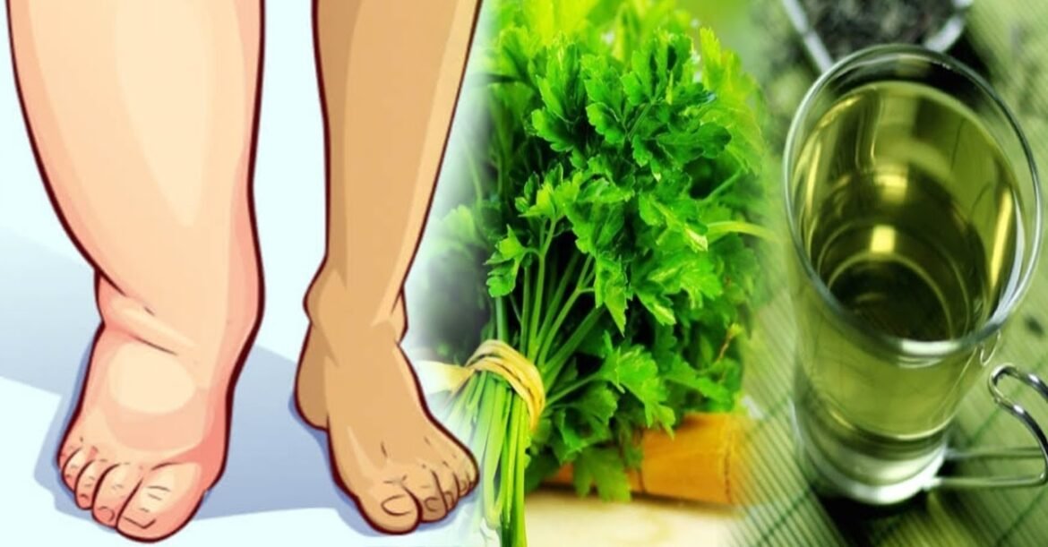 Drink Parsley Tea to Reduce Swollen Legs and Improve Kidney Health