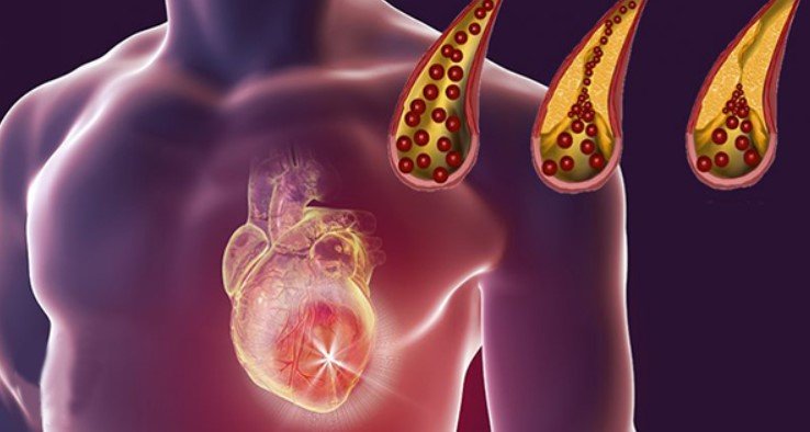 10 Heart-Saving Foods That Naturally Clean Your Arteries