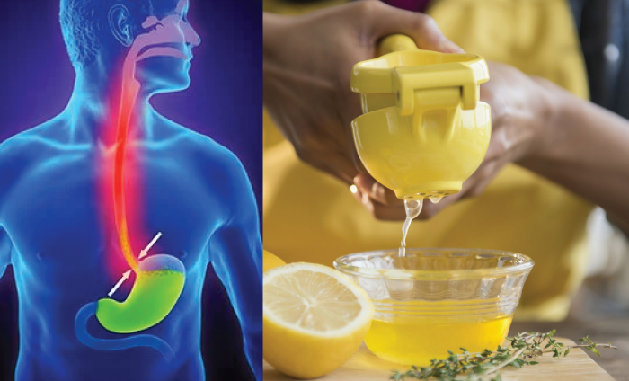 10 Natural Heartburn Remedies That Actually Stop the Burn Fast