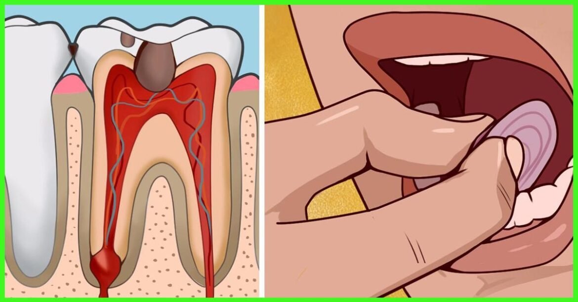 10 Secret Natural Toothache Cures Dentists Won’t Tell You