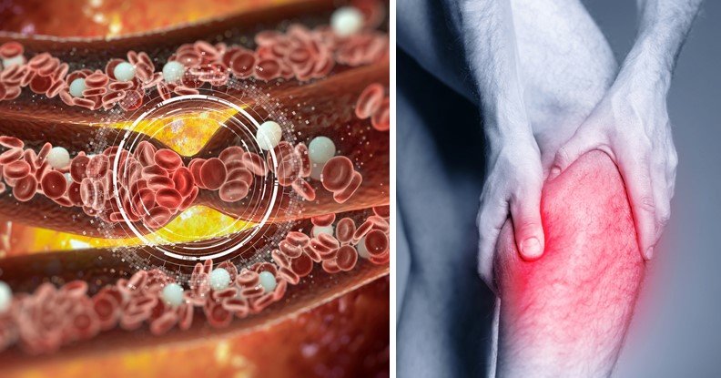 11 Proven Ways to Boost Blood Flow and Protect Your Heart