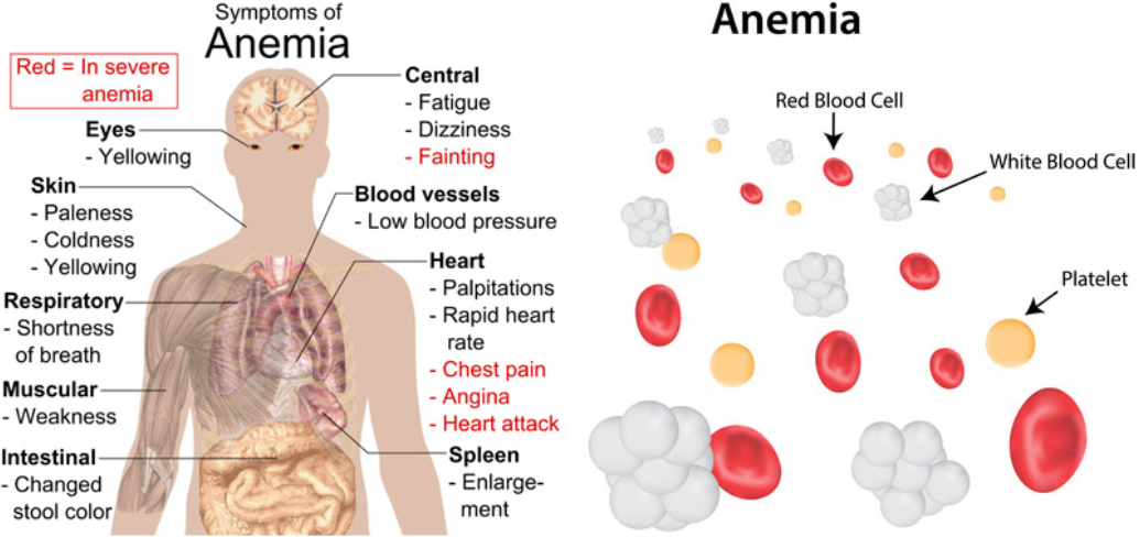 15 Best Foods That Secretly Cure Anemia Fast!