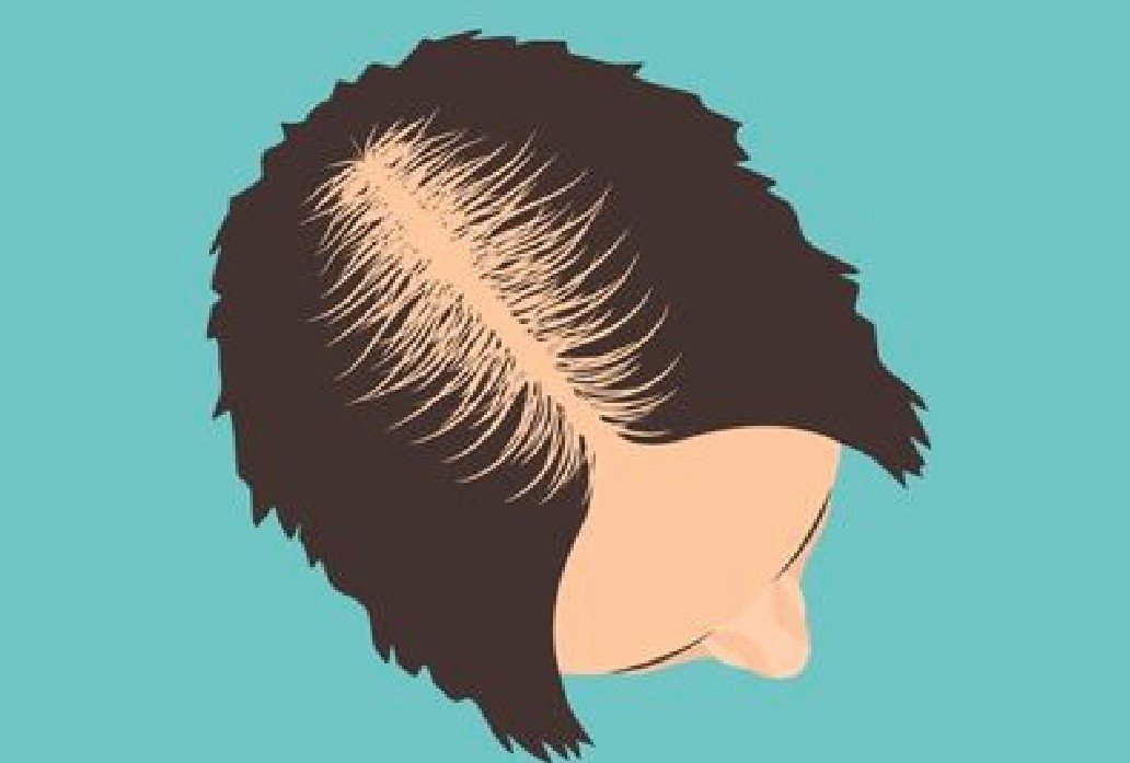 6 Hair Warning Signs Your Body Is Secretly Sending You