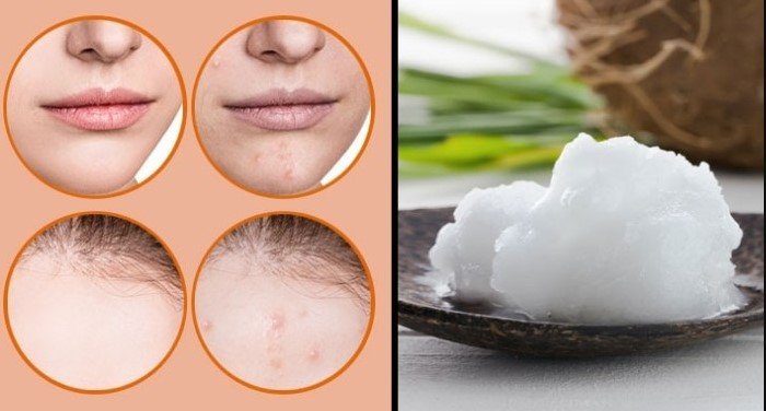 7 DIY Face Washes to Melt Years Off Your Skin Instantly