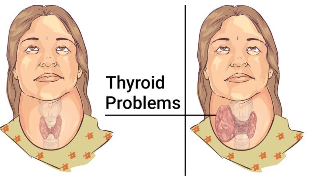 Boost Your Thyroid: 8 Powerful Foods That Heal Naturally