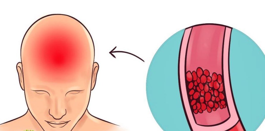 The Mineral Secret: 3 Vitamins That Crush Headaches, Sleepless Nights & Fatigue