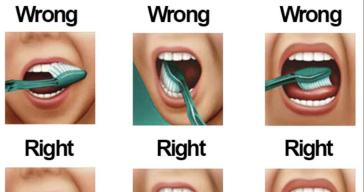 Brush Like a Pro: 7 Secrets to Perfect Teeth Every Time!