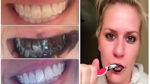 Shocking Secret: 7-Day Guide to Brilliant White Teeth Revealed!