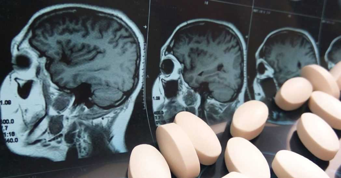 The Dark Side of Statins: How Cholesterol Drugs Alter Your Mind