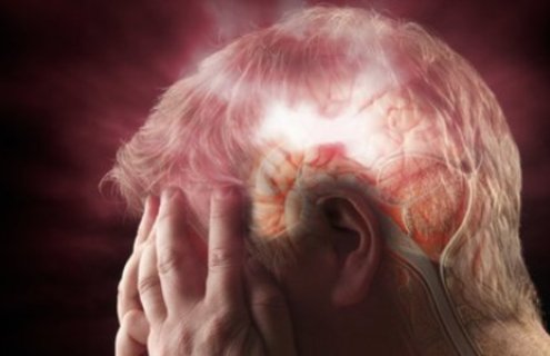 9 Shocking Stroke Symptoms You Can’t Afford to Ignore