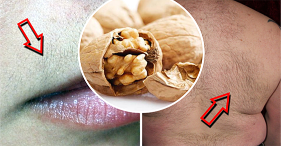 Ancient Hair Removal Secrets: 5 Shocking Recipes From Medieval Medicine