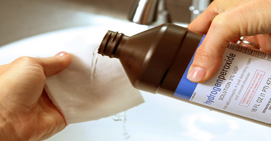 Hydrogen Peroxide Secrets: 34 Mind-Blowing Uses Revealed!