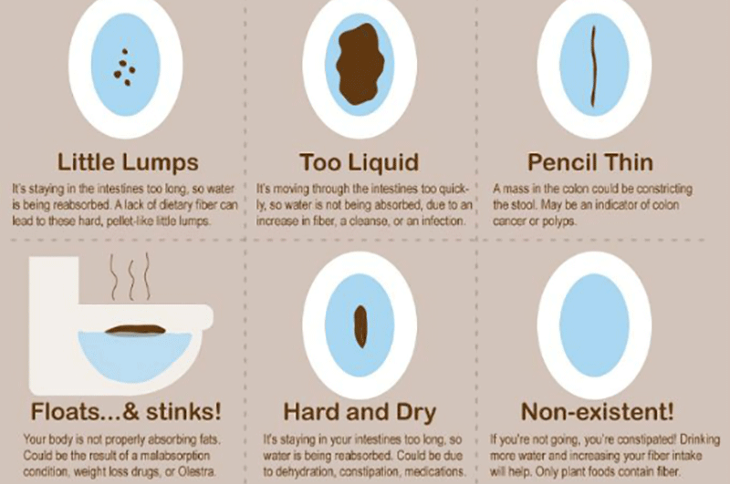 Poop Secrets Revealed: 7 Surprising Health Insights