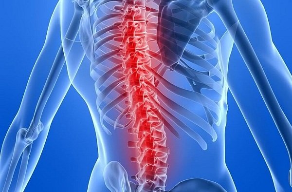 The Ultimate Natural Hack: 7 Spine-Saving Pain Relief Secrets Doctors Won’t Tell You