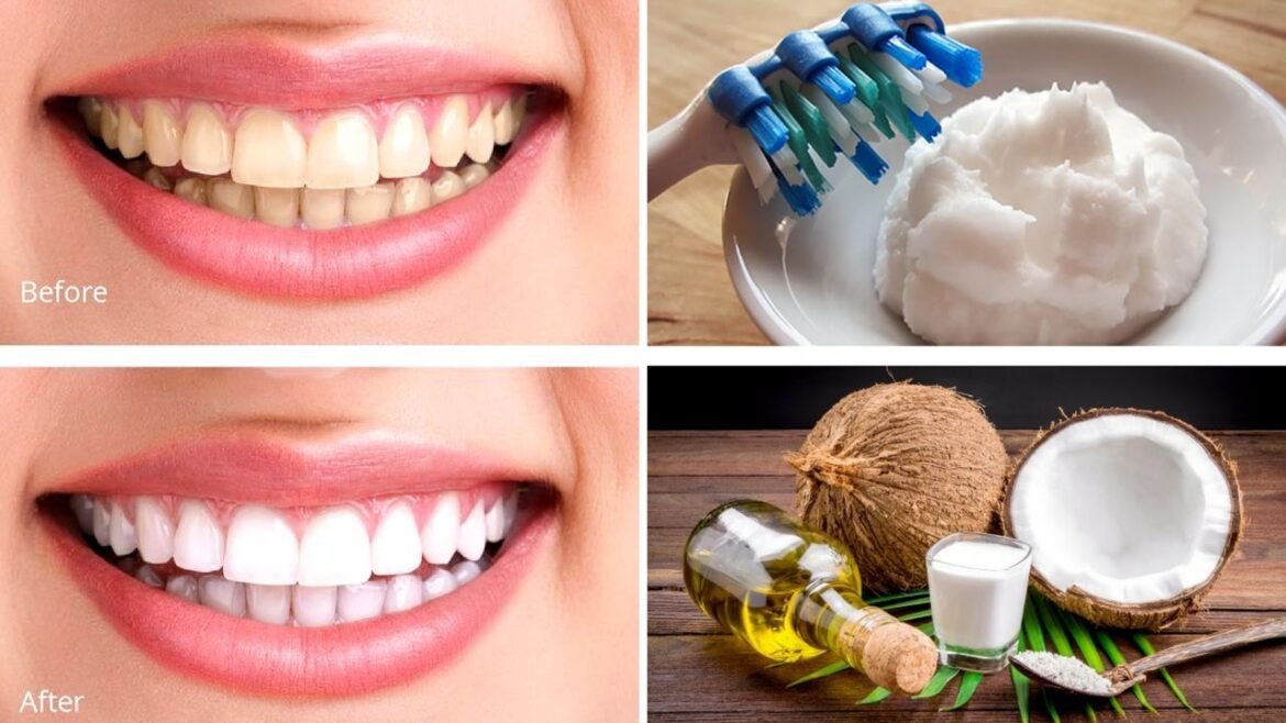 Coconut Oil: The Natural Weapon Against Deadly Dental Bacteria